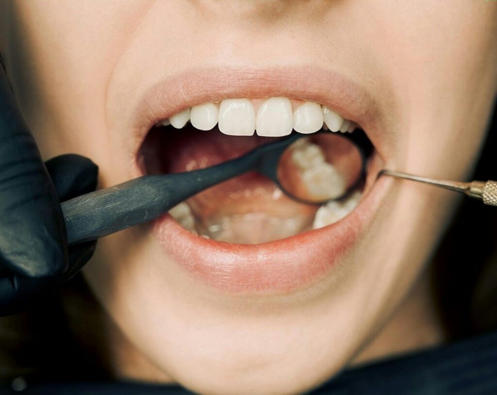 Bad Breath? Here’s What Might Be Causing It (And How to Fix It)