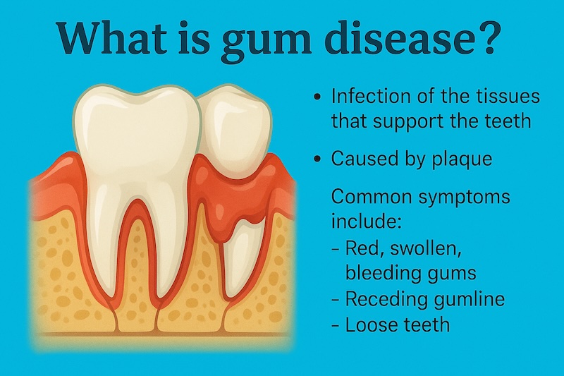 What is gum disease-optimized What is gum disease-optimized